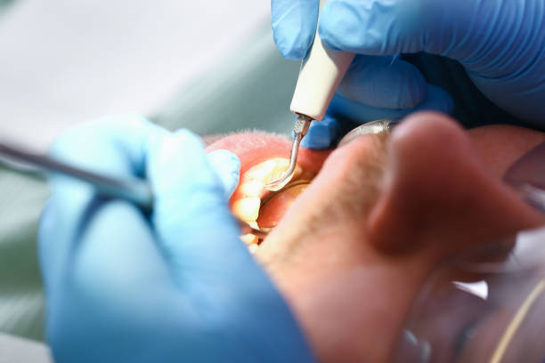 Best Emergency Denture Repair in Steelton, PA